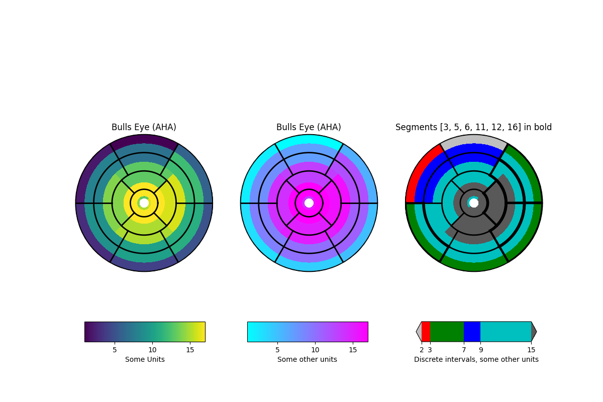 Bulls Eye (AHA), Bulls Eye (AHA), Segmenti [3, 5, 6, 11, 12, 16] in grassetto