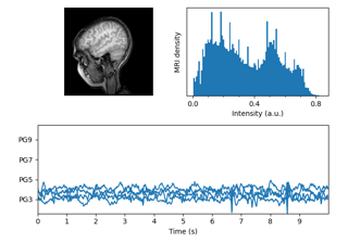 Risonanza magnetica con EEG